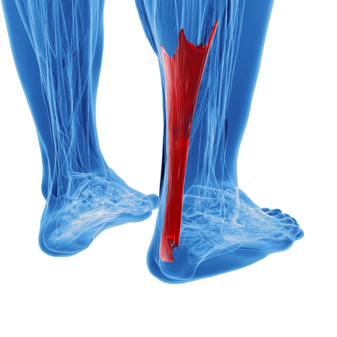 featured image thumbnail for post Achilles Tendonopathy